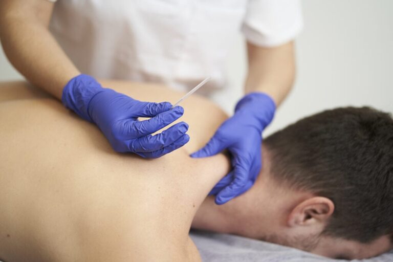 dry-needling-1024x683